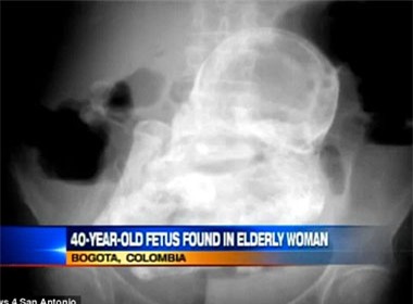 Khách Sạn Phố Cổ Bình Thạnh