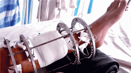 Khách Sạn Phố Cổ Bình Thạnh