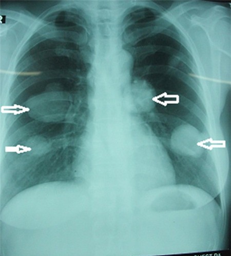 Khách Sạn Phố Cổ Bình Thạnh